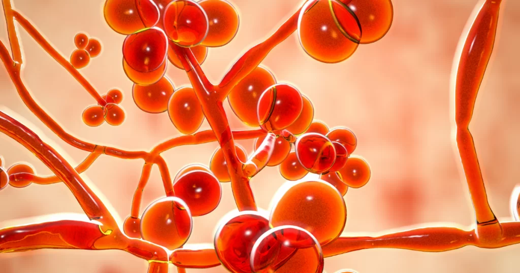 Candida Belirtileri Nelerdir?