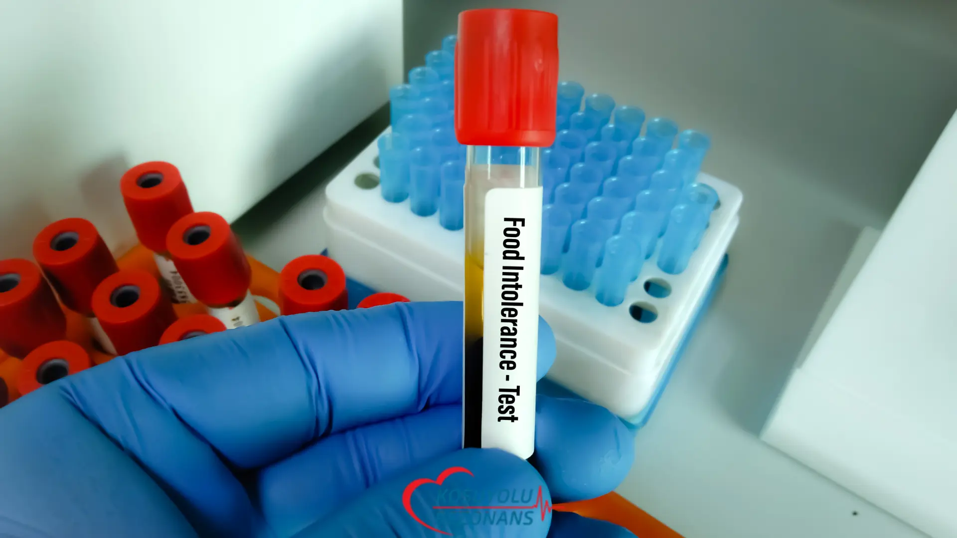 Gıda İntolerans Testi Nasıl Yapılır?